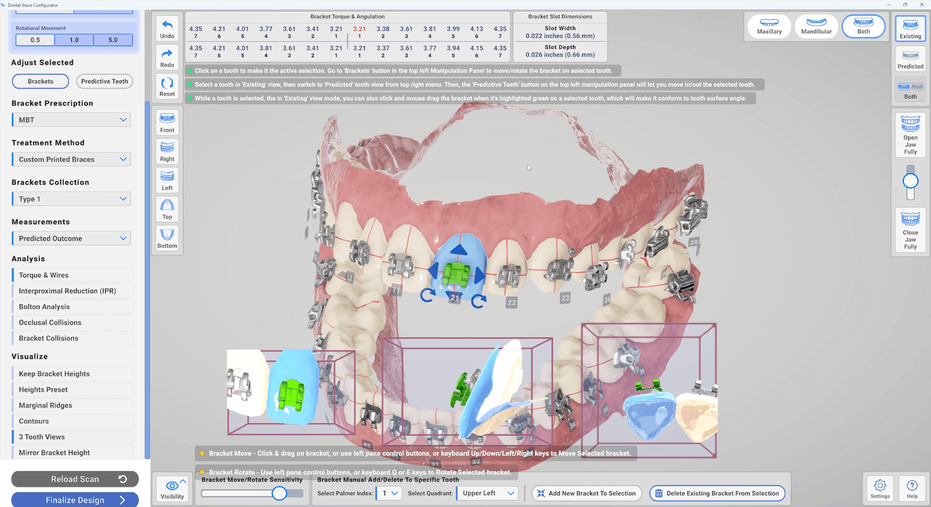 3D Dental Bracket Configurator SaaS